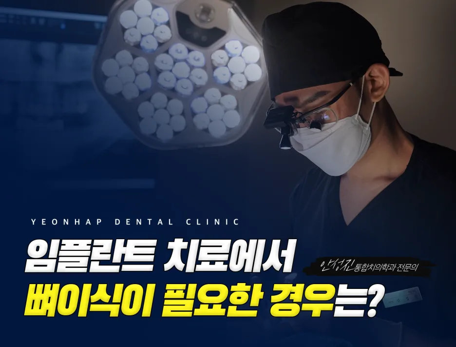 [수원 탑동치과] 상악동거상술, 연합치과의원의 3가지 진료 기준
