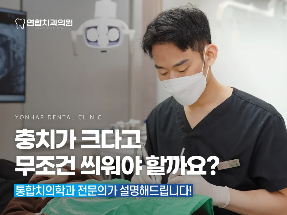 충치가 크다고 무조건 씌워야 할까요?