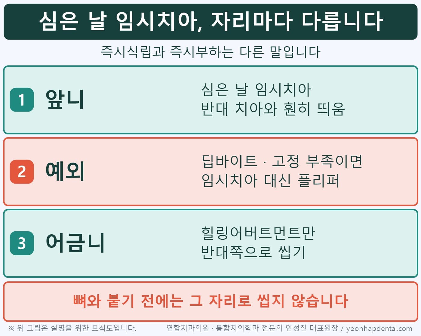 발치즉시 임플란트 임시치아 규칙 인포그래픽, 앞니 당일 임시치아·예외는 플리퍼·어금니는 힐링어버트먼트