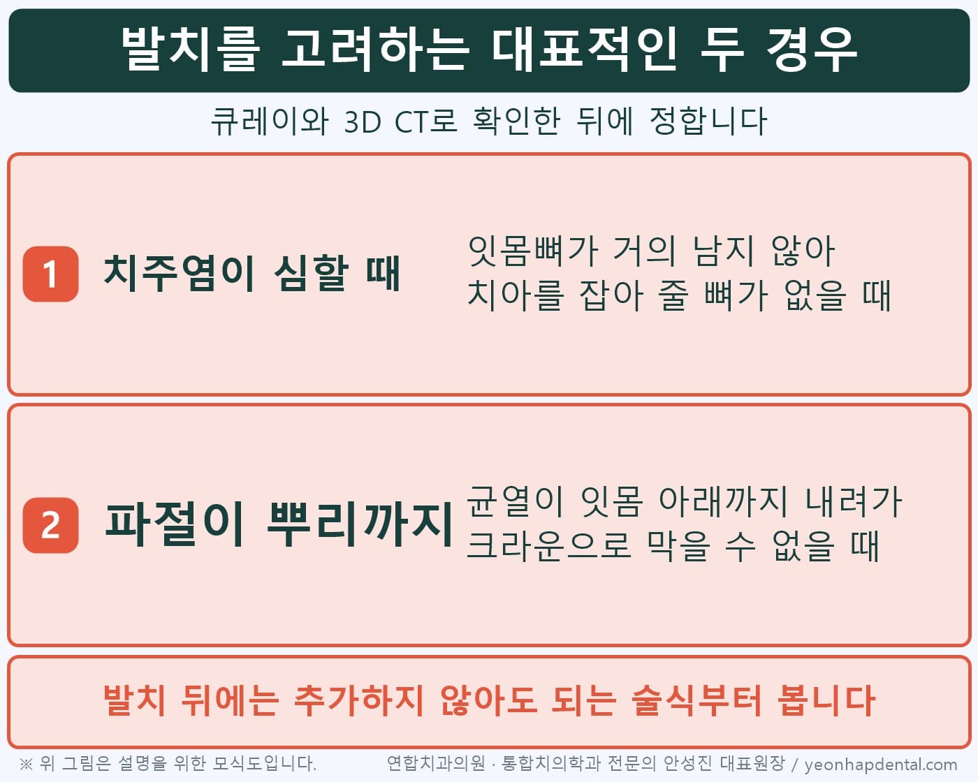 발치를 고려하는 대표적인 두 경우, 치주염이 너무 심할 때와 파절이 뿌리까지 갔을 때 인포그래픽