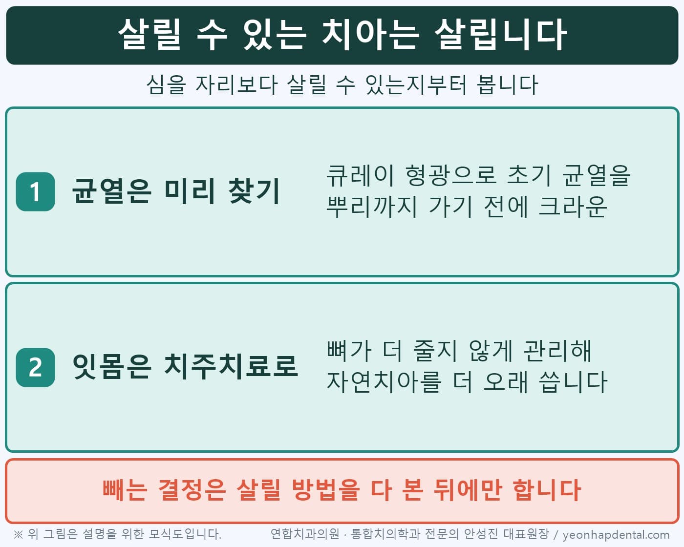 살릴 수 있는 치아는 살리는 쪽으로, 큐레이 균열 조기 발견과 치주치료 유지 두 가지 인포그래픽