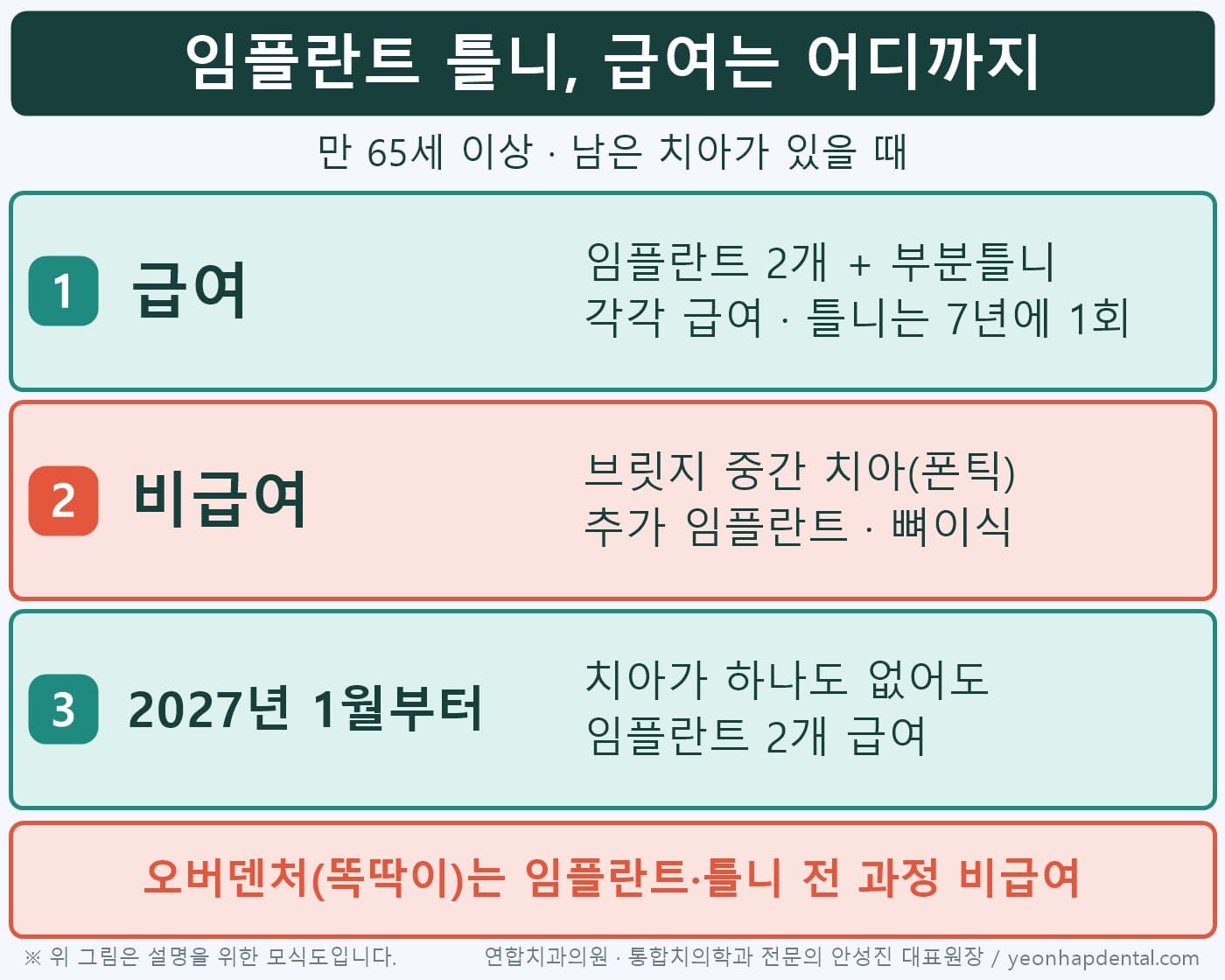 임플란트 틀니 급여 범위 도식: 임플란트 2개와 부분틀니 급여, 브릿지 중간 치아 비급여, 2027년 완전무치악 확대