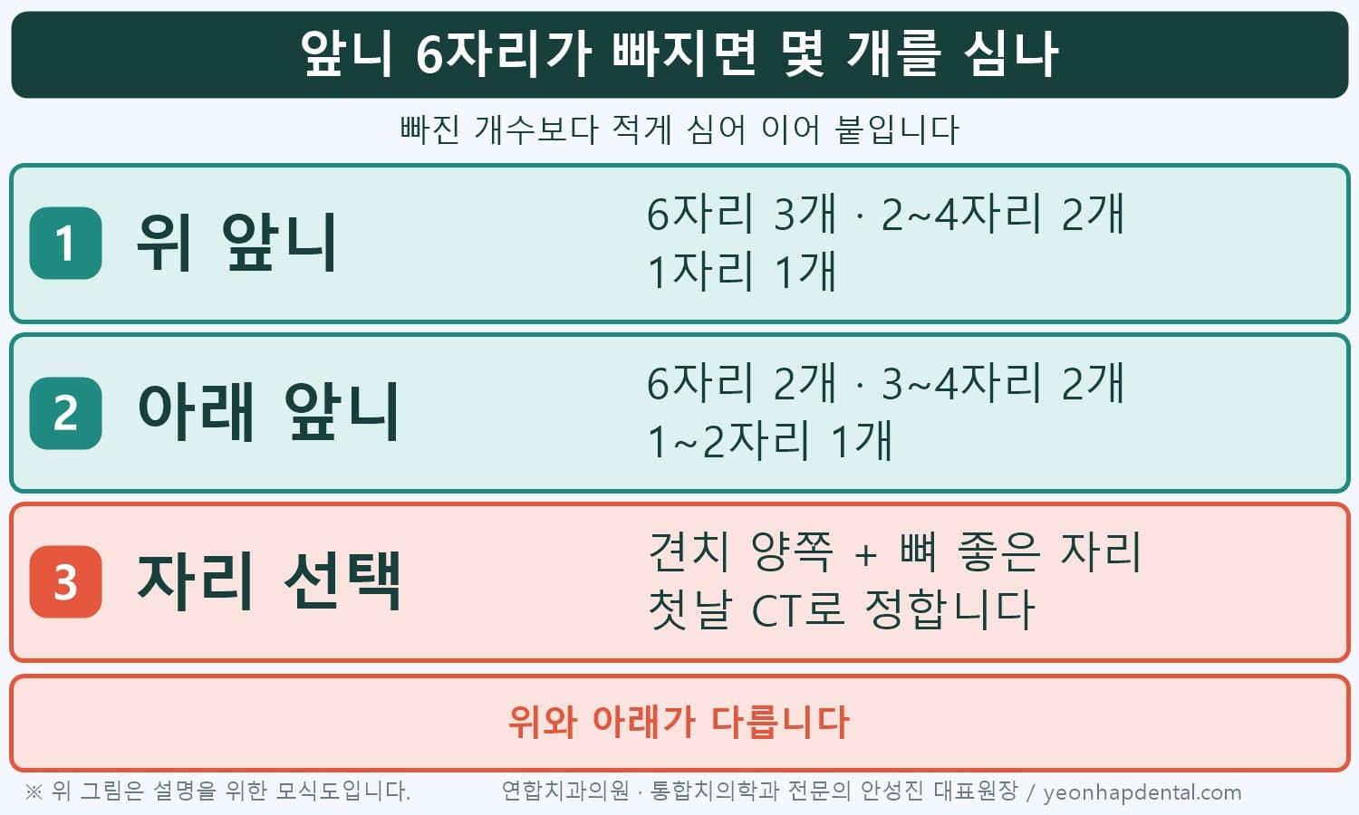 앞니 빠진 개수별 심는 임플란트 개수 인포그래픽, 위 6자리 3개·아래 6자리 2개