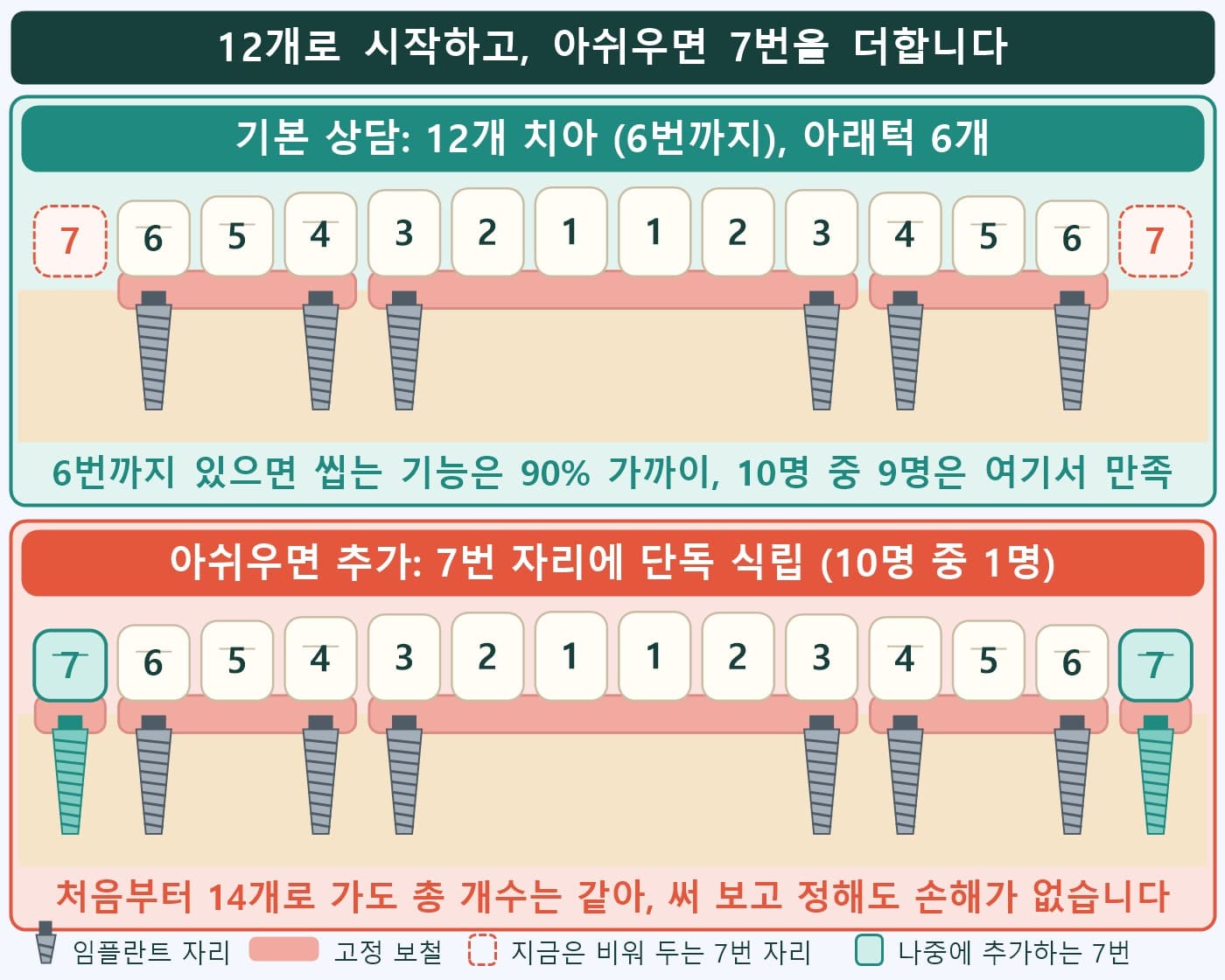 12개 치아 기준 아래턱 6개로 시작하고 아쉬우면 7번을 단독으로 추가하는 전체임플란트 계획 도식