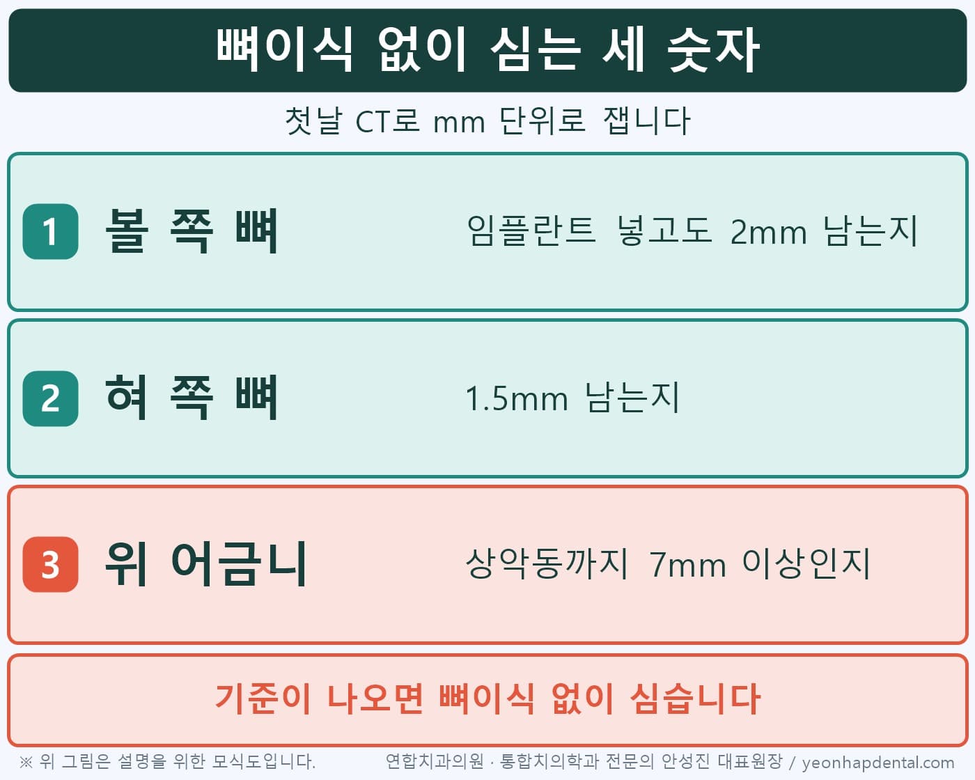 볼 쪽 2mm, 혀 쪽 1.5mm, 상악동 7mm 기준으로 뼈이식 없이 심는 자리를 고르는 인포그래픽