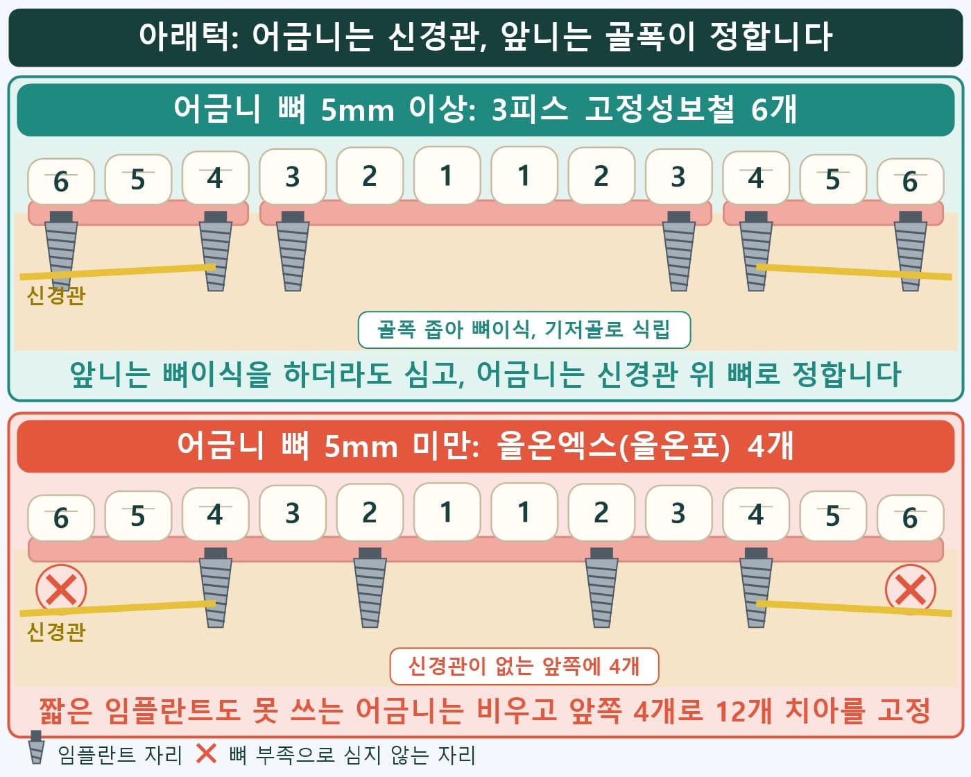 아래턱 신경관과 앞니 골폭을 표시한 도식, 어금니 뼈 5mm 이상이면 6개, 미만이면 올온엑스(올온포) 4개