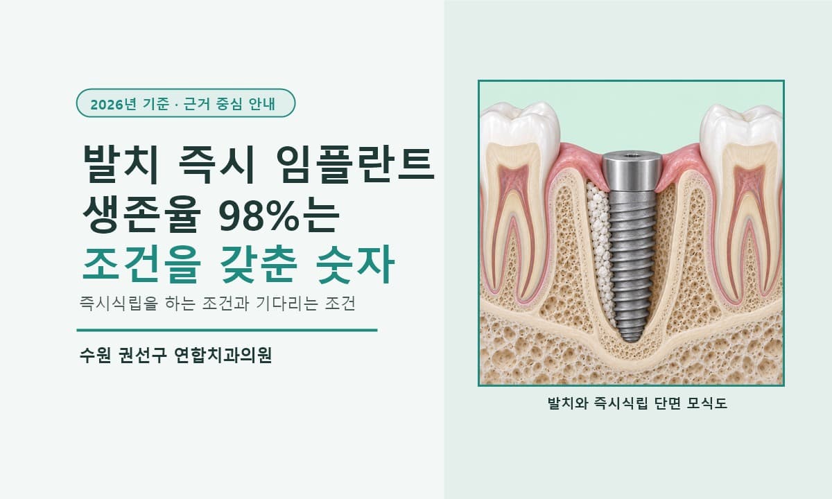 수원 발치 즉시 임플란트, 생존율 98%는 조건을 갖춘 경우의 숫자입니다 (2026년 기준)