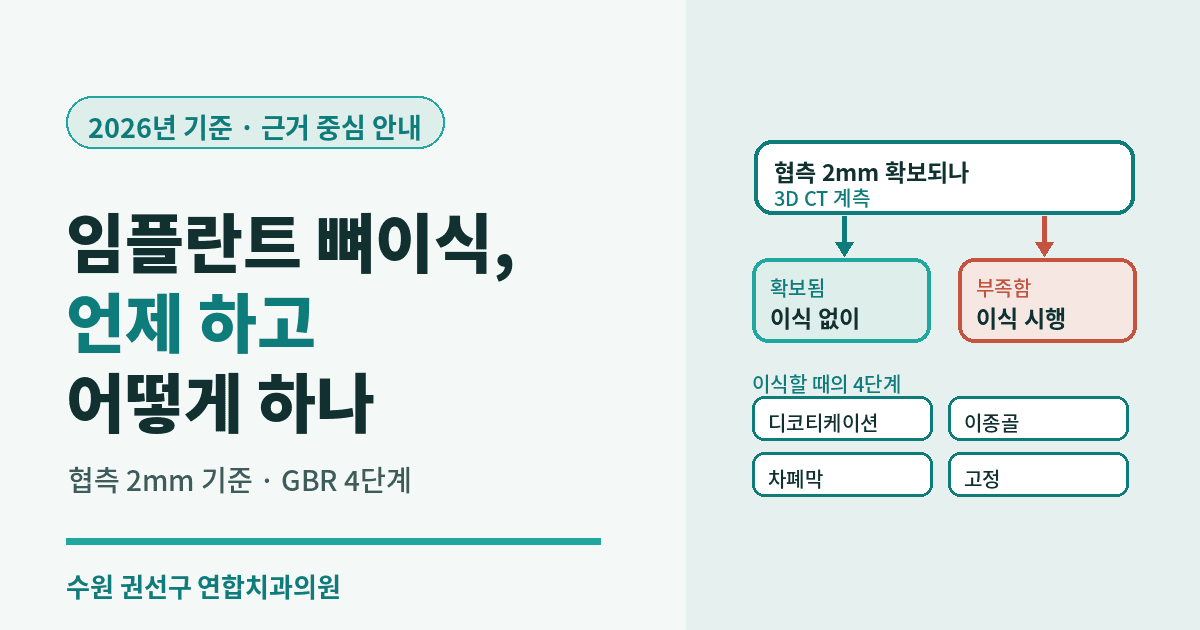 수원 권선구 임플란트 뼈이식 - 언제 하고 어떻게 하나 (2026년 기준)