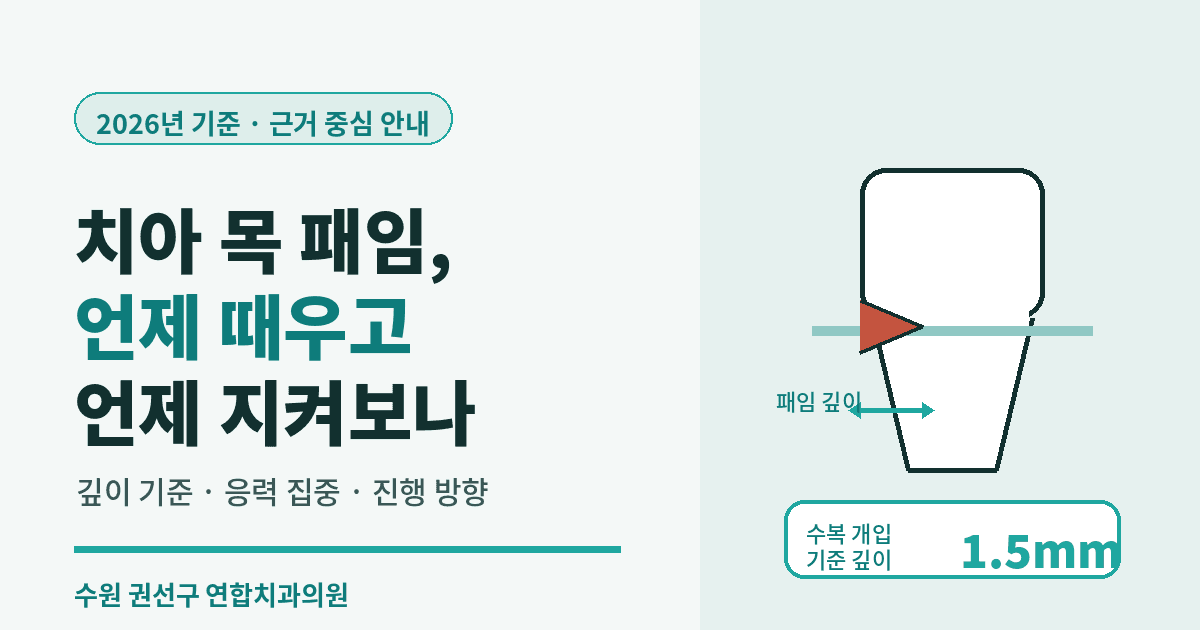 수원 탑동치과 치경부마모, 언제 때우고 언제 지켜보나