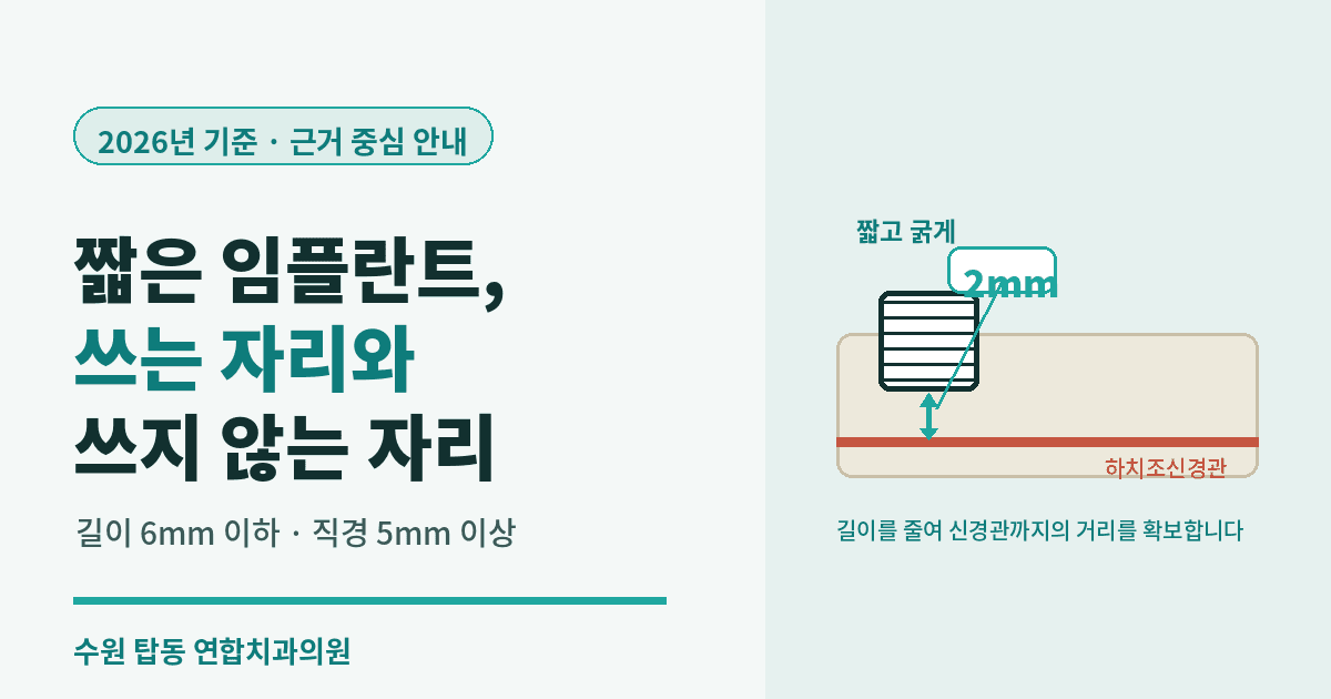 수원 권선구 숏임플란트 - 뼈이식 없이 임플란트 하는 기준 및 방법 (2026년 기준)