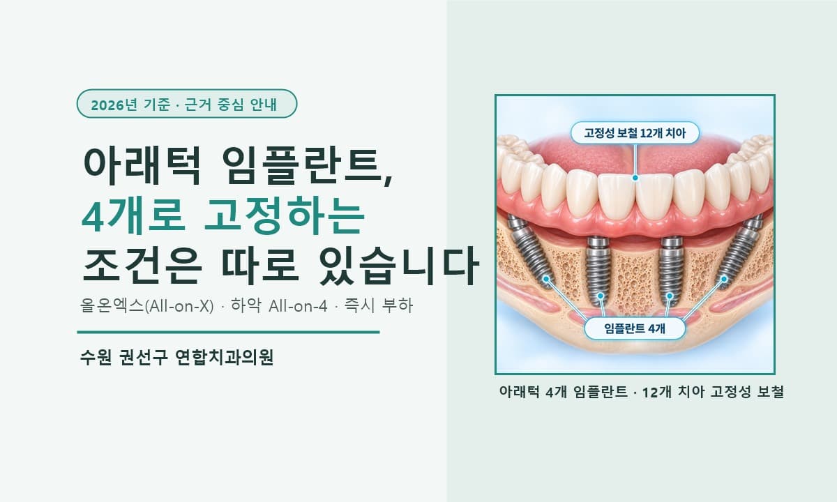수원 올온엑스, 전체임플란트랑 무엇이 다를까 (2026년 기준)
