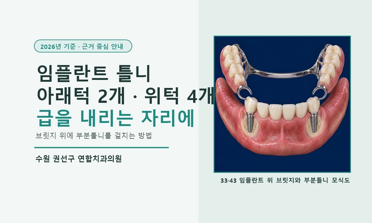 수원 임플란트 틀니(IARPD), 아래턱은 2개·위턱은 4개가 기준인 이유 (2026년 기준)