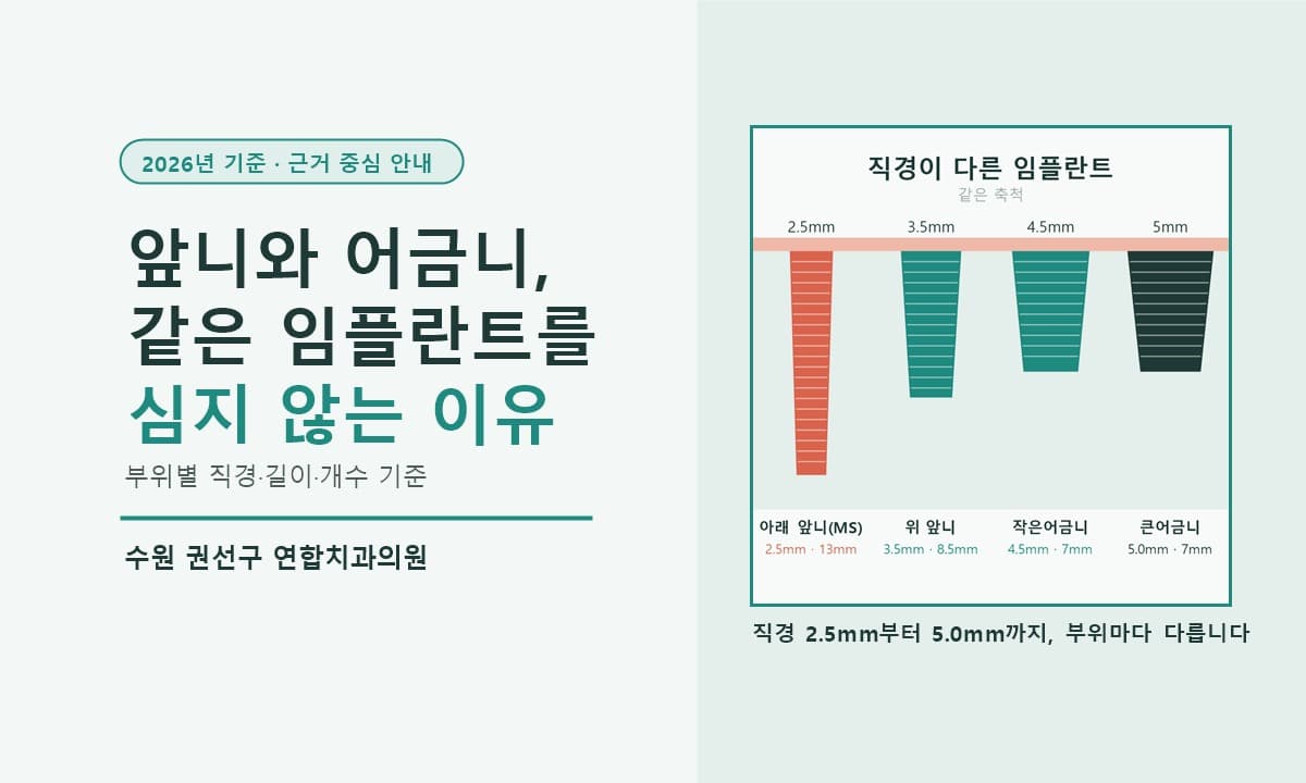 수원 앞니 임플란트와 어금니 임플란트, 굵기·길이·개수가 다른 이유 (2026년 기준)